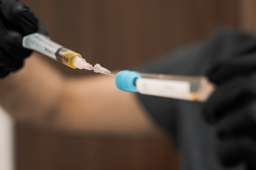 PRP Treatment Los Angeles, CA